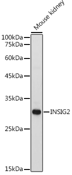 INSIG2 Polyclonal Antibody