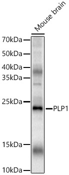 PLP1 Polyclonal Antibody