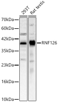 RNF126 Polyclonal Antibody