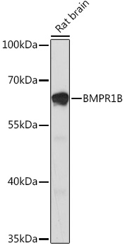 BMPR1B Polyclonal Antibody