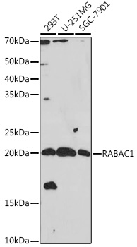 RABAC1 Polyclonal Antibody