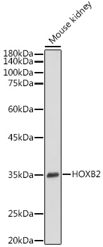 HOXB2 Polyclonal Antibody