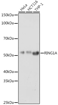 RING1A Polyclonal Antibody