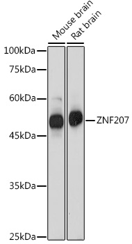 ZNF207 Polyclonal Antibody