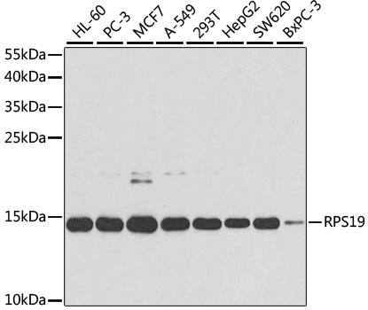 RPS19 Polyclonal Antibody