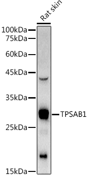 TPSAB1 Polyclonal Antibody