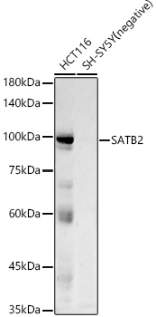 SATB2 Monoclonal Antibody [3F9E1]