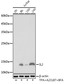 IL2 Monoclonal Antibody [5M4Y3]