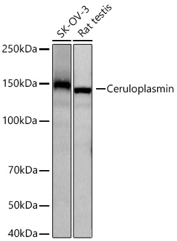 Ceruloplasmin Monoclonal Antibody [6C3K9]