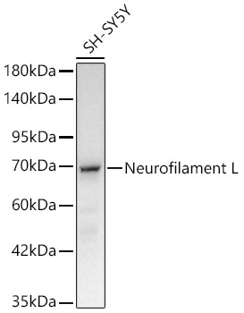 Neurofilament L Monoclonal Antibody [3L9Y10]