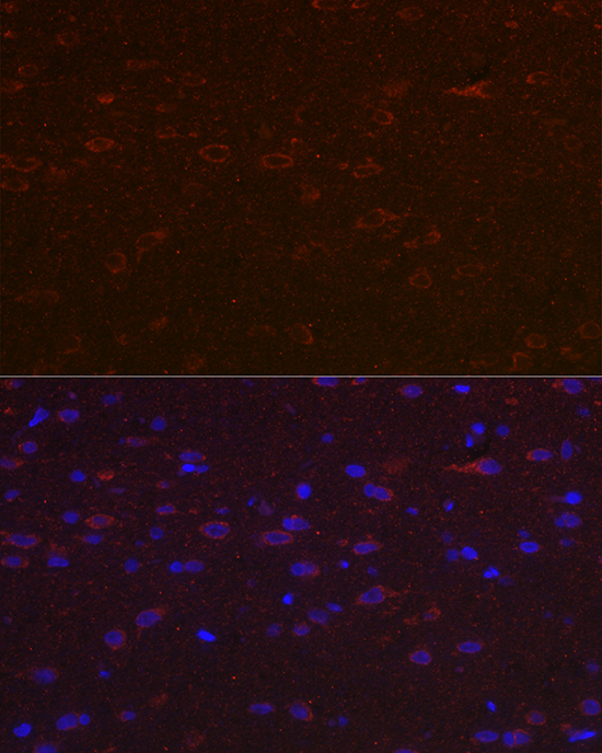 Versican Polyclonal Antibody
