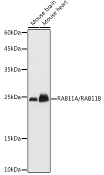 RAB11A/RAB11B Polyclonal Antibody