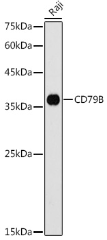 CD79B Polyclonal Antibody