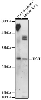 TIGIT Polyclonal Antibody