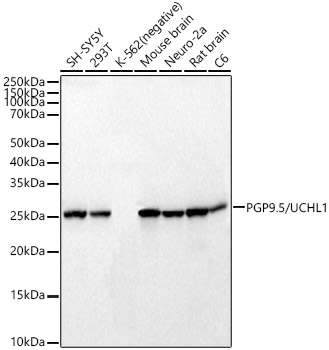 PGP9.5/UCHL1 Monoclonal Antibody [3G3Z10]