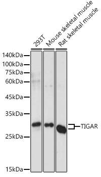 TIGAR Polyclonal Antibody