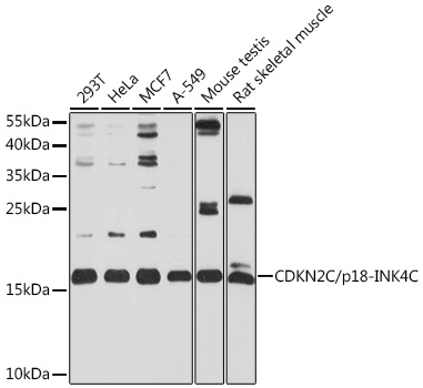 CDKN2C/p18-INK4C Polyclonal Antibody