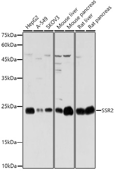 SSR2 Polyclonal Antibody