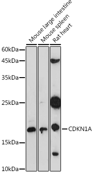 CDKN1A Polyclonal Antibody