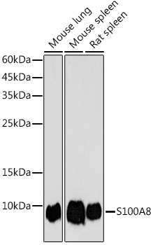 S100A8 Polyclonal Antibody