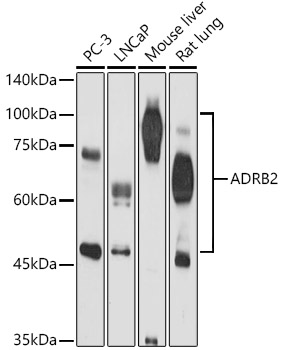 ADRB2 Polyclonal Antibody&nbsp;<img src="images/icon_newarrival.gif" alt="new" border="0">