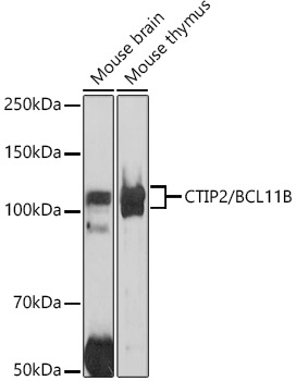 CTIP2/BCL11B Polyclonal Antibody