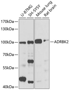 ADRBK2 Polyclonal Antibody&nbsp;<img src="images/icon_newarrival.gif" alt="new" border="0">