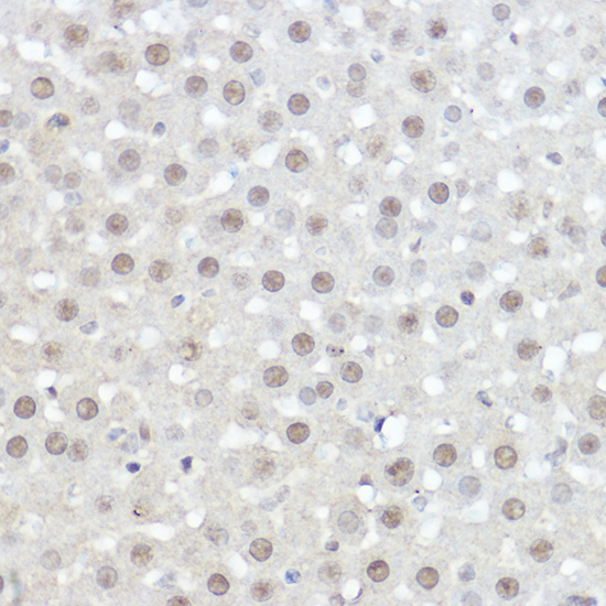 AHNAK Polyclonal Antibody