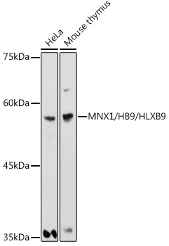 MNX1/HB9/HLXB9 Polyclonal Antibody