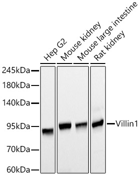 Villin1 Monoclonal Antibody [7H4F1]