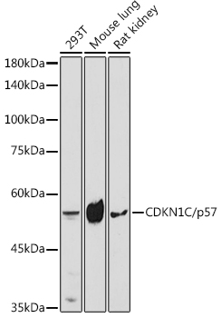 CDKN1C/p57 Kip2 Polyclonal Antibody