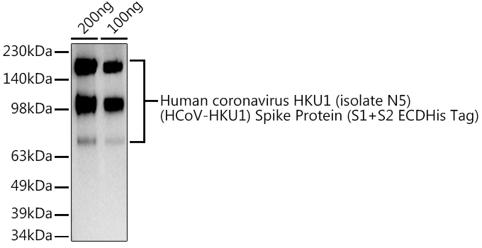 HCoV-HKU1 Spike S1 Polyclonal Antibody