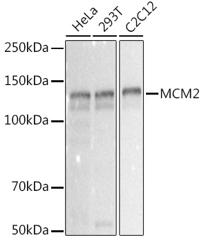 MCM2 Monoclonal Antibody [0Q10S9]