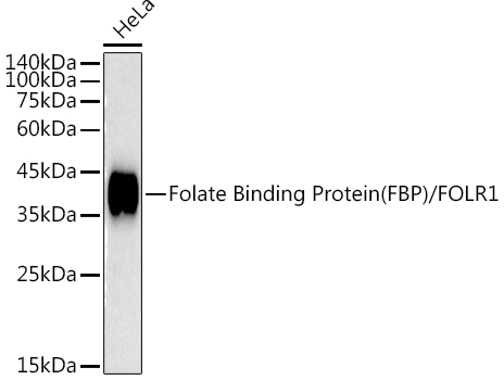 Folate Binding Protein(FBP) / FOLR1 Monoclonal Antibody [3J6W3]
