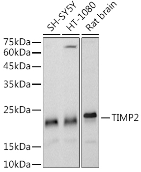 TIMP2 Monoclonal Antibody [5P3T3]