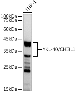 YKL-40/CHI3L1 Monoclonal Antibody [7T1R3]