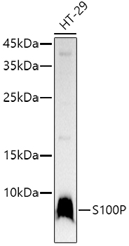 S100P Monoclonal Antibody [1E1M2]