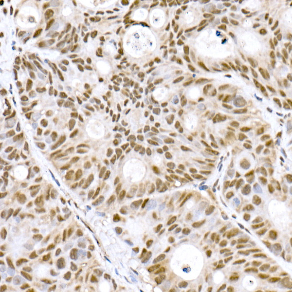 Prdm9 Monoclonal Antibody [1H9Z1]