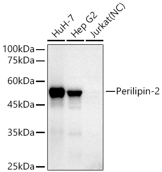 Perilipin-2 Monoclonal Antibody [9W7Y9]