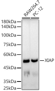XIAP Monoclonal Antibody [5S5Q7]