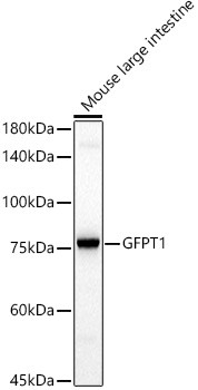 GFPT1 Monoclonal Antibody [6H9F2]