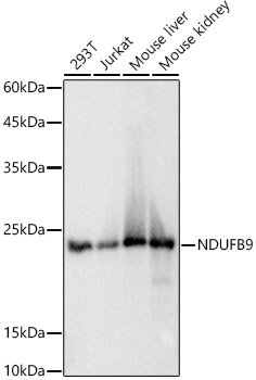 NDUFB9 Monoclonal Antibody [8P3V2]