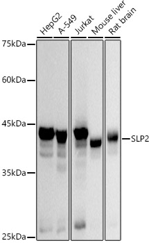 SLP2 Monoclonal Antibody [5R4B4]