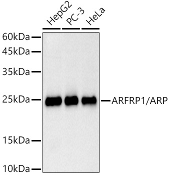 ARFRP1 / ARP Monoclonal Antibody [7M6W3]