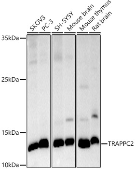 TRAPPC2 Monoclonal Antibody [6S3A7]