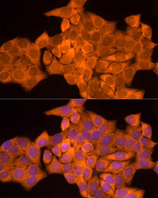 NAT1 Monoclonal Antibody [8X8I4]