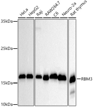 RBM3 Monoclonal Antibody [3M9V6]