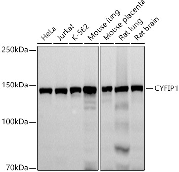 CYFIP1 Monoclonal Antibody [2M3F4]