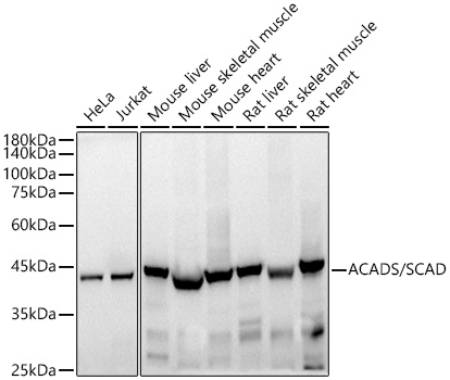 ACADS / SCAD Monoclonal Antibody [6W2A8]