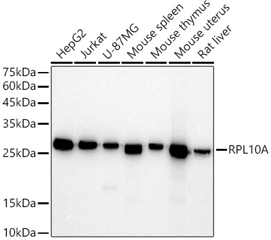RPL10A Monoclonal Antibody [3D5C8]